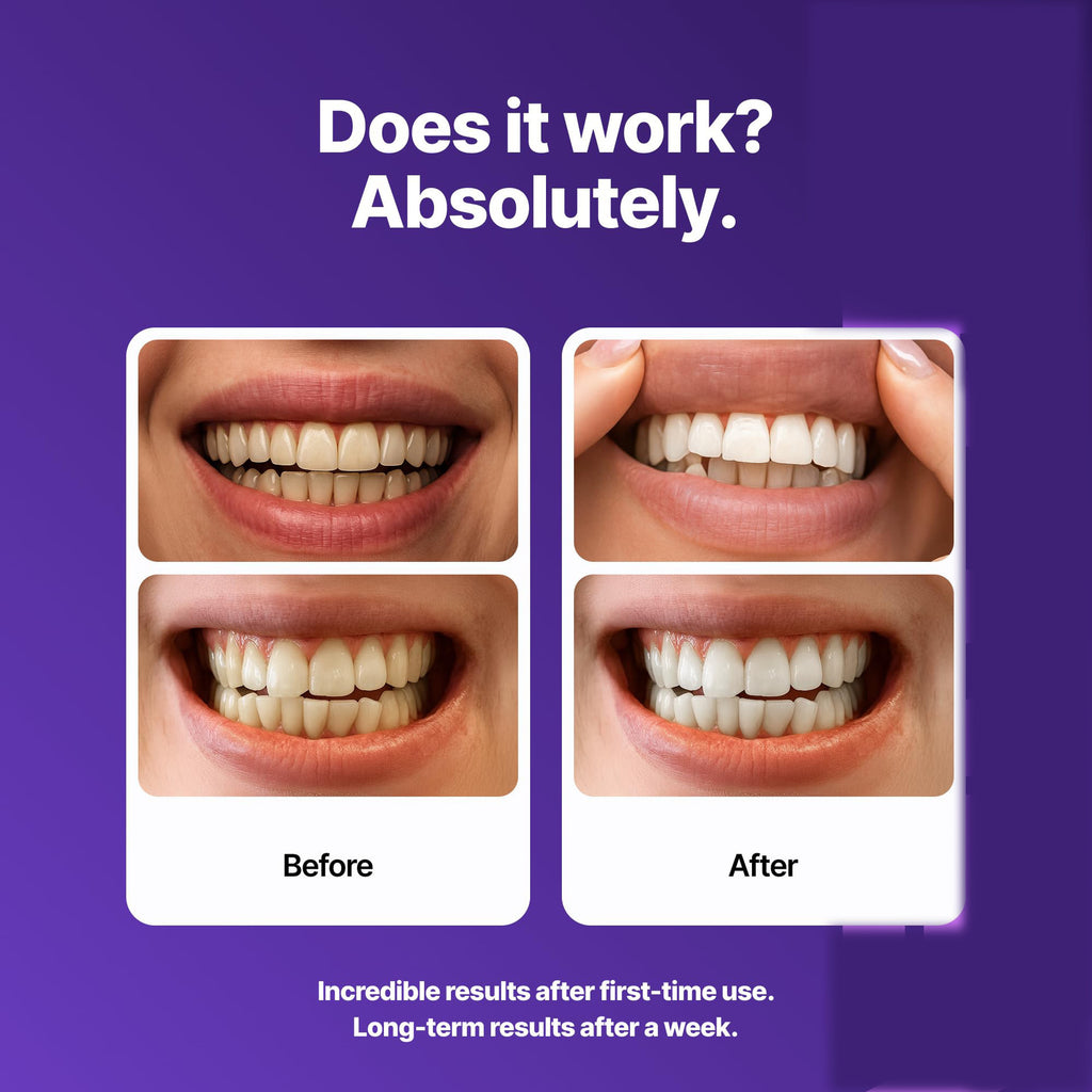 DR.DENT Purple Teeth Whitening Strips